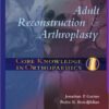 Core Knowledge in Orthopaedics: Adult Reconstruction and Arthroplasty, 1e 1st Edition