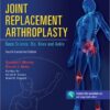 Joint Replacement Arthroplasty: Basic Science, Hip, Knee, and Ankle 4th Edition