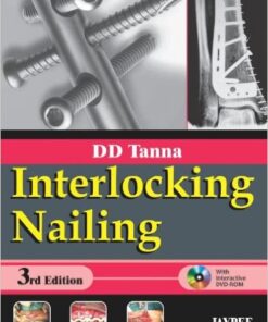 Interlocking Nailing 3 Har/Dvdr Edition