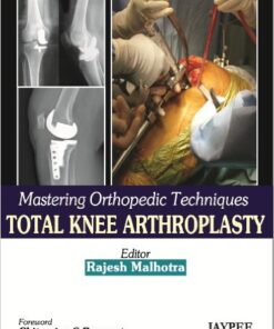 Mastering Orthopedic Techniques Total Knee Arthroplasty 1st Edition