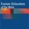 Fracture-Dislocations of the Wrist  1 Edition