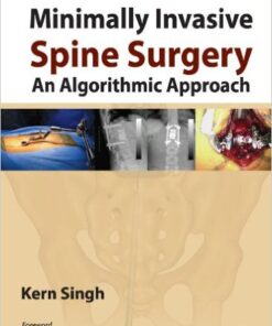 Minimally Invasive Spine Surgery: An Algorithmic Approach 1st Edition