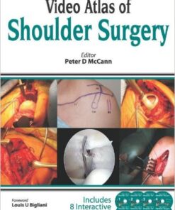 Video Atlas of Shoulder Surgery1 Edition