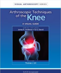 Arthroscopic Techniques of the Knee: A Visual Guide (Visual Arthroscopy) 1st Edition