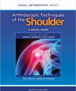 Arthrscopic Techniques of the Shoulder: A Visual Guide (Visual Arthroscopy) 1st Edition