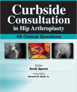 Curbside Consultation in Hip Arthroplasty: 49 Clinical Questions 1st Edition