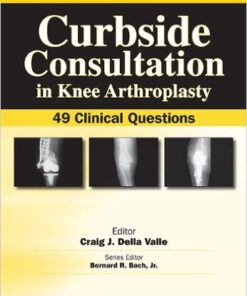 Curbside Consultation in Knee Arthroplasty: 49 Clinical Questions 1st Edition