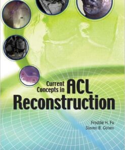 Current Concepts in ACL Reconstruction 1st Edition