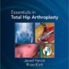 Essentials in Total Hip Arthroplasty 1st Edition