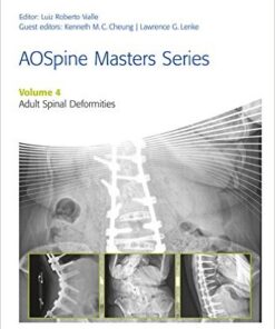 AOSpine Masters Series, Volume 4: Adult Spinal Deformities Kindle Edition