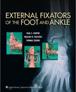 External Fixators of the Foot and Ankle 1st Edition