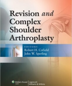 Revision and Complex Shoulder Arthroplasty 1st Edition