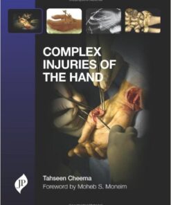 Complex Injuries of the Hand 1st Edition