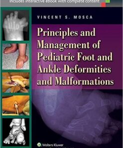 Principles and Management of Pediatric Foot and Ankle Deformities and Malformations First Edition