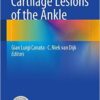 Cartilage Lesions of the Ankle 2015th Edition