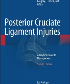 Posterior Cruciate Ligament Injuries: A Practical Guide to Management 2nd ed. 2015 Edition