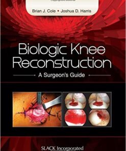 Biologic Knee Reconstruction: A Surgeon's Guide 1st Edition