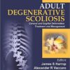 Adult Degenerative Scoliosis: Coronal and Sagittal Deformities: Treatment and Management 1st Edition