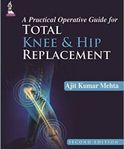 A Practical Operative Guide for Total Knee and Hip Replacement 2nd Edition