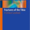 Fractures of the Tibia: A Clinical Casebook 1st ed. 2016 Edition