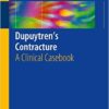 Dupuytren's Contracture: A Clinical Casebook 1st ed. 2016 Edition