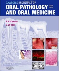 Cawson's Essentials of Oral Pathology and Oral Medicine, 8e 8th Edition