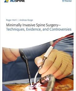 Minimally Invasive Spine Surgery - Techniques, Evidence, and Controversies 1st Edition