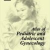 Atlas of Pediatric and Adolescent Gynecology 2nd Edition