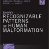 Smith's Recognizable Patterns of Human Malformation 7e