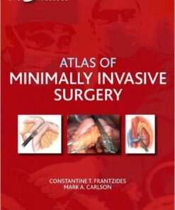 Atlas of Minimally Invasive Surgery