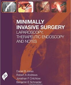 Minimally Invasive Surgery: Laparoscopy, Therapeutic Endoscopy and Notes 1st Edition