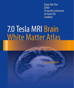 7.0 Tesla MRI Brain White Matter Atlas 2nd ed. 2015 Edition