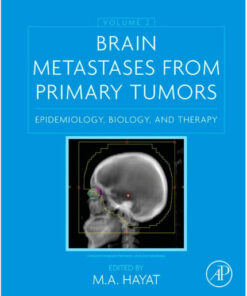 Brain Metastases from Primary Tumors, Volume 2: Epidemiology, Biology, and Therapy 1st Edition