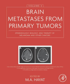 Brain Metastases from Primary Tumors, Volume 3: Epidemiology, Biology, and Therapy of Melanoma and Other Cancers 1st Edition