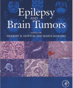 Epilepsy and Brain Tumors 1st Edition