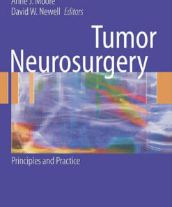 Tumor Neurosurgery: Principles and Practice