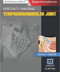 Specialty Imaging: Temporomandibular Joint, 1e PDF