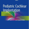 Pediatric Cochlear Implantation: Learning and the Brain 1st ed. 2016 Edition