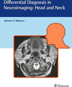 Differential Diagnosis in Neuroimaging: Head and Neck 1st Edition