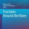 Fractures Around the Knee 2016