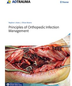 Principles of Orthopedic Infection Management