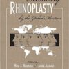 Secondary Rhinoplasty by the Global Masters 1st Edition PDF ORIGINAL + Video