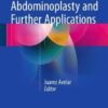 New Concepts on Abdominoplasty and Further Applications 2016