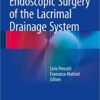 Endoscopic Surgery of the Lacrimal Drainage System 1st ed. 2016 Edition