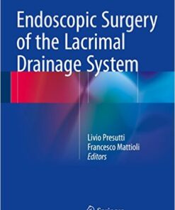 Endoscopic Surgery of the Lacrimal Drainage System 1st ed. 2016 Edition