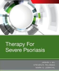 Therapy for Severe Psoriasis