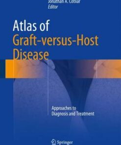 Atlas of Graft-versus-Host Disease 2017 : Approaches to Diagnosis and Treatment