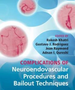 Complications of Neuroendovascular Procedures and Bailout Techniques