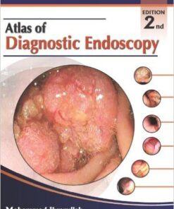 Atlas of Diagnostic Endoscopy