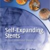 Self-Expanding Stents in Gastrointestinal Endoscopy 1st Edition